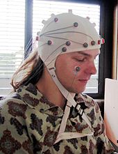 Photo of the head of a young man, with what looks like a while shower cap on his head, with a number of dark blobs scattered around it with wires attached to them.