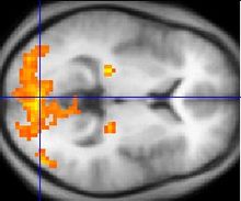 Imagen monocroma fMRI de una sección transversal horizontal de un cerebro humano. A pocas regiones, sobre todo en la parte trasera, se resaltan en naranja y amarillo.