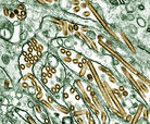 Tintadas micrografía electrónica de transmisión de la gripe aviar A H5N1 viruses.jpg