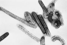 An electron micrograph of the filamentous Marburg virus