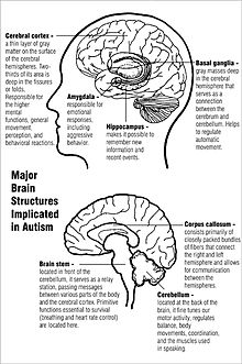 Dois diagramas das principais estruturas cerebrais implicados no autismo. O diagrama superior mostra o córtex cerebral perto do topo e os gânglios basais no centro, logo acima da amígdala e hipocampo. O diagrama inferior mostra o corpo caloso perto do centro, o cerebelo na parte inferior traseira, e o tronco cerebral na parte central inferior.