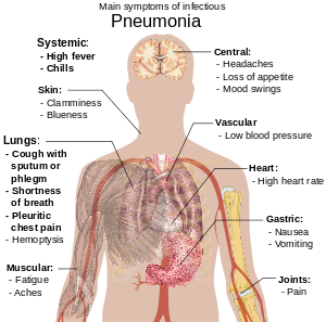 Um diagrama do corpo humano descrevendo os principais sintomas de pneumonia